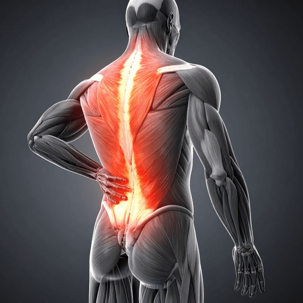 A 3D anatomical model of a human back from behind, with the upper and lower back muscles highlighted in glowing red to indicate inflammation or pain.